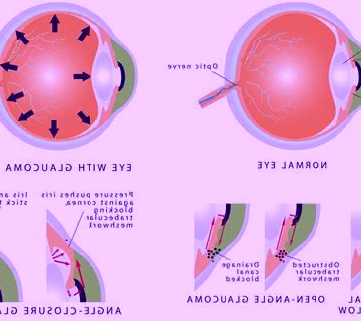 Celexa acute angle closure glaucoma celexa medication