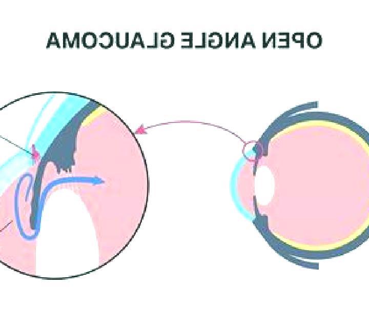 Celexa acute angle closure glaucoma celexa pills