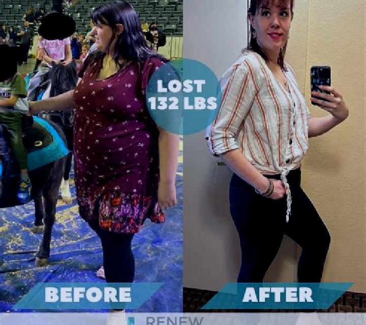 Celexa celexa after gastric bypass pharmacy