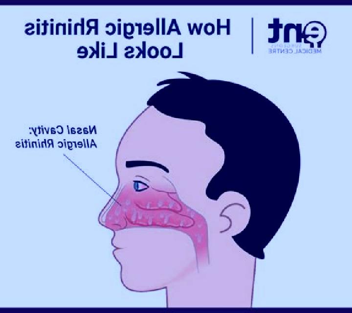 Celexa celexa causes non allergic rhinitis pharmacy