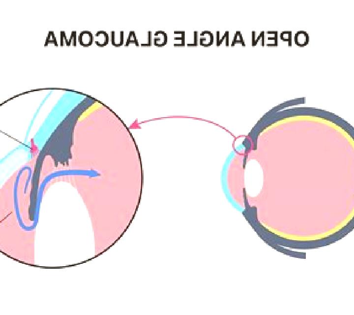 Celexa celexa open angle glaucoma tablet