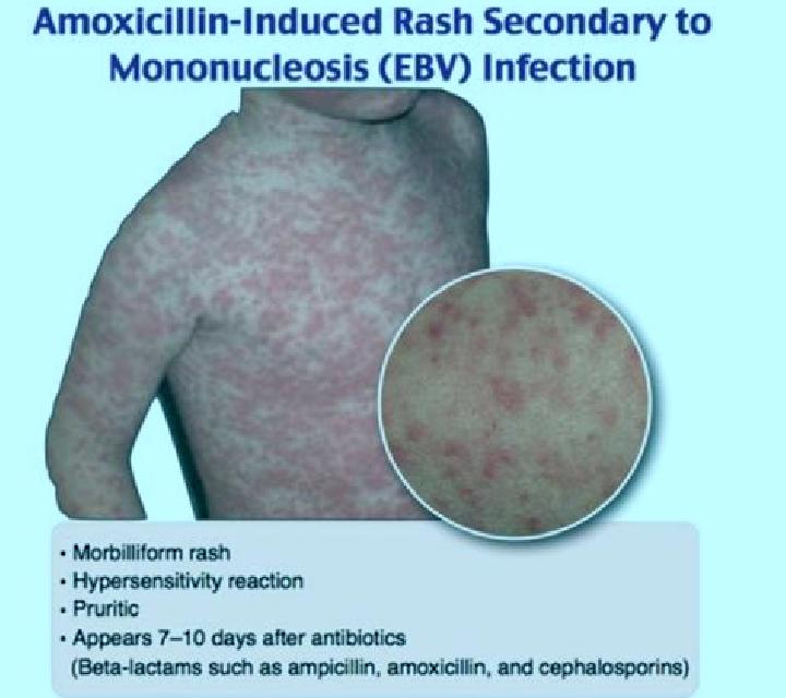 Celexa celexa side effects in newborns medication
