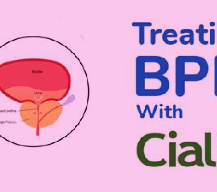 Cialis cialis for bph dose medication