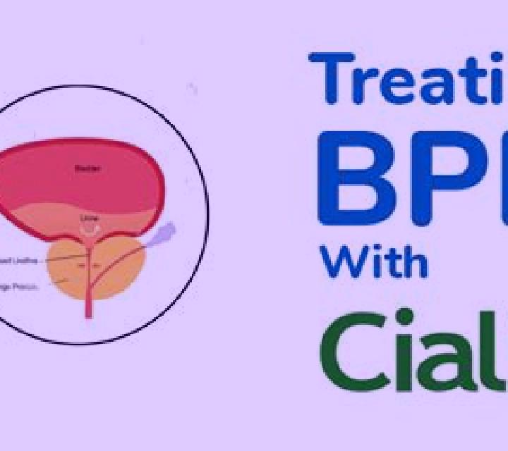 Cialis cialis help bph pills