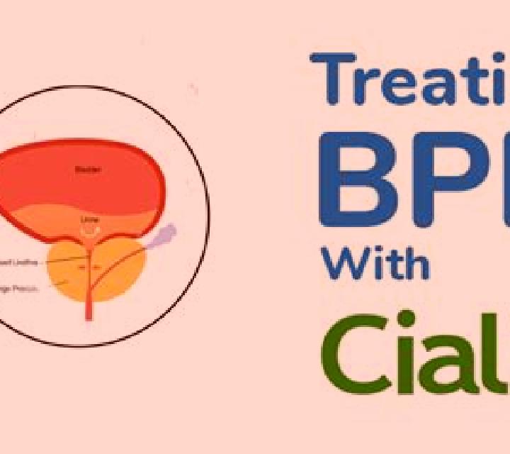 Cialis does cialis help bph medication