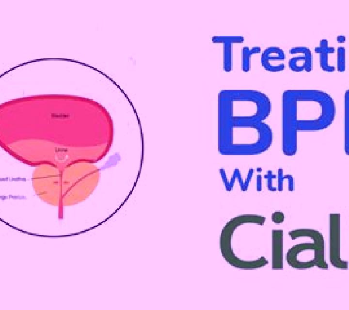 Cialis does cialis help bph pills