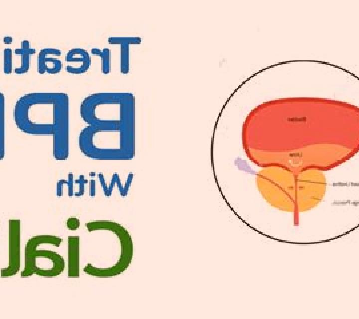 Cialis how does cialis help bph pills