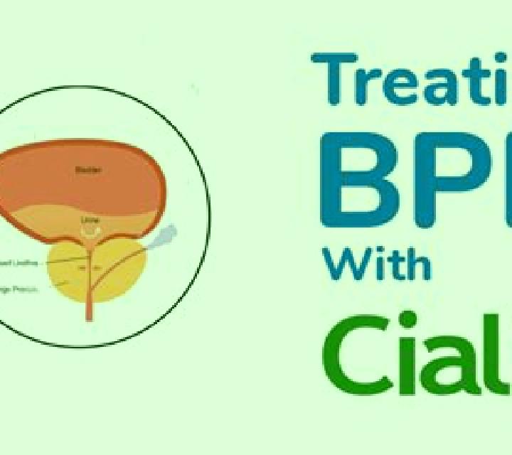 Cialis how quickly does cialis work for bph medication