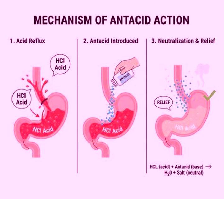 Flagyl flagyl acid reflux medication