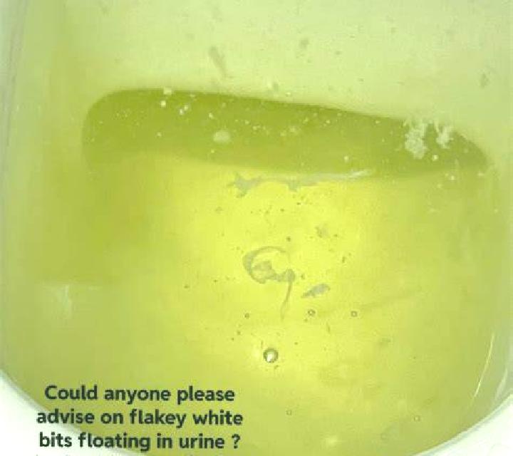 Flagyl flagyl cloudy urine medication