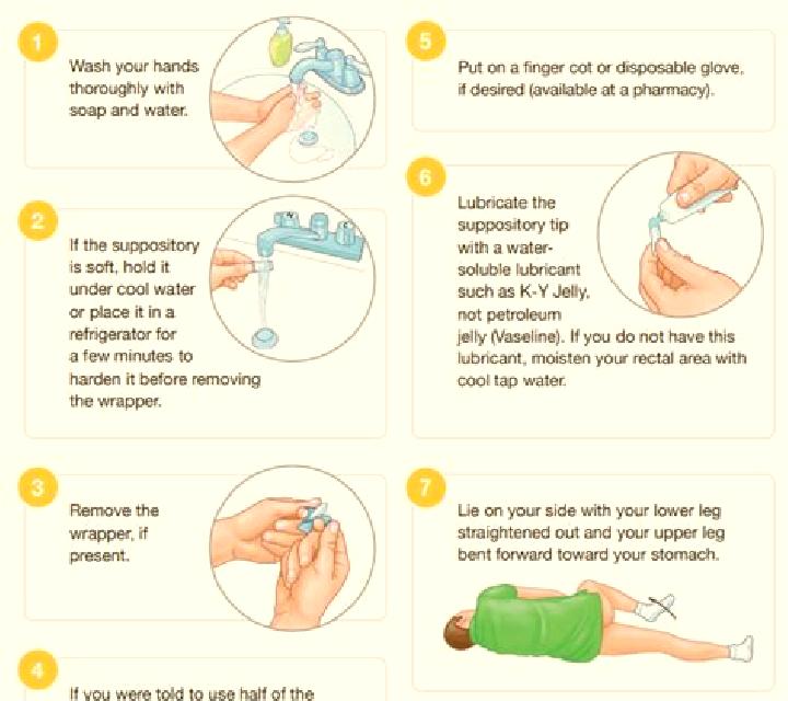 Flagyl flagyl suppositories how to use pills