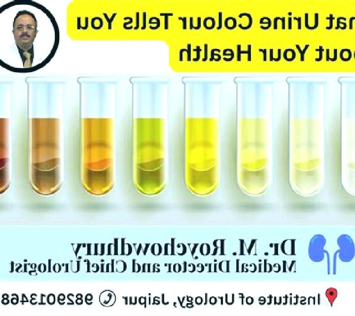 Flagyl urine colour after using flagyl pills