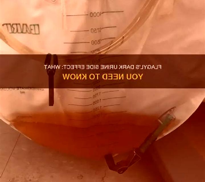 Flagyl why does flagyl cause dark urine pharmacy
