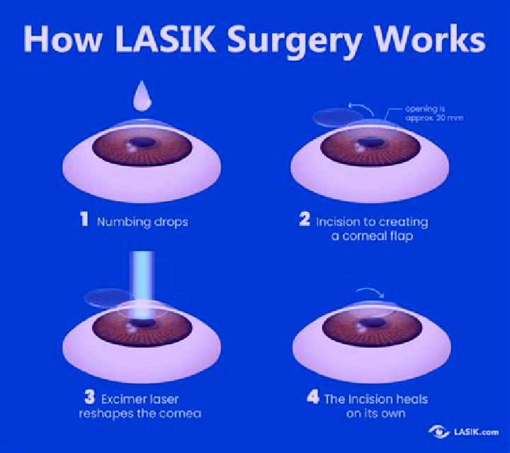 Lasix adjustment after lasix surgery tablet