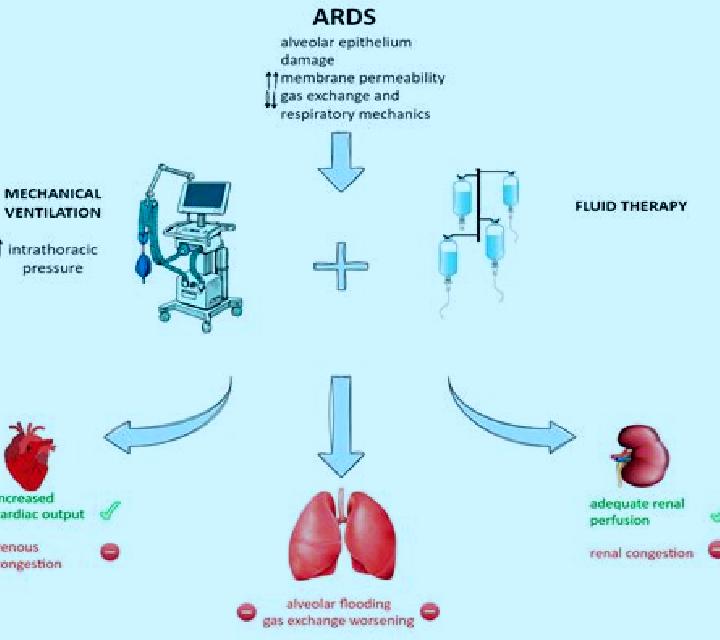 Lasix ards treatment lasix medication