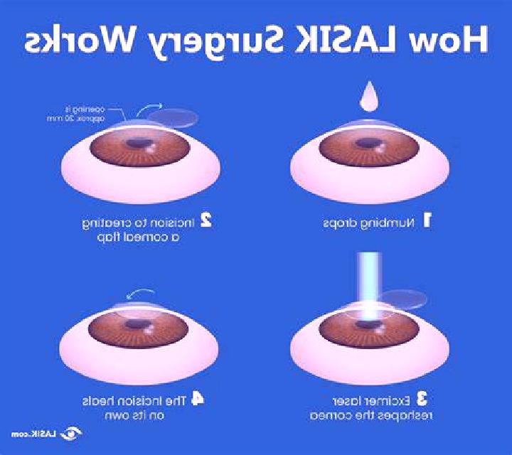 Lasix can i get lasix before cataract surgery tablet