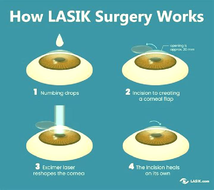 Lasix can lasix affect your vision medication