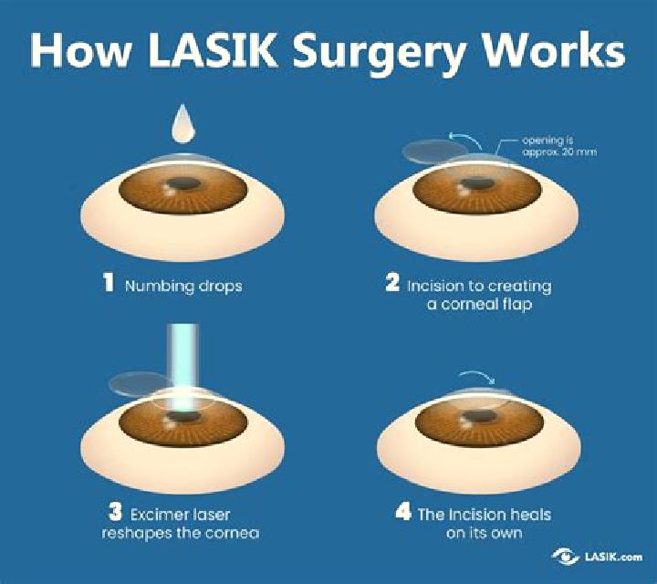 Lasix can lasix help farsightedness tablet