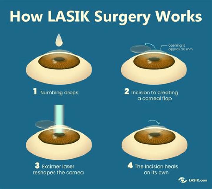 Lasix coat for lasix aurgery pharmacy