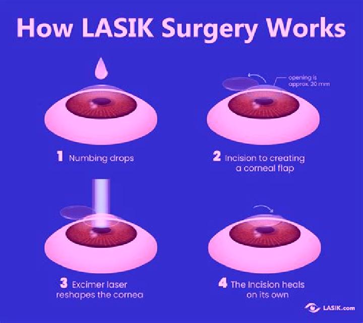 Lasix does having lasix affect future cataracts pharmacy
