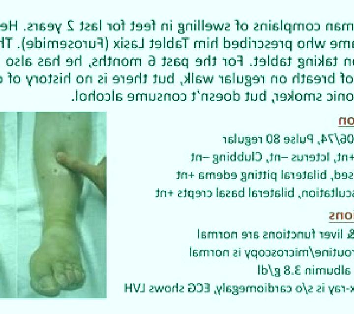 Lasix does increasing lasix cause leg swelling pharmacy
