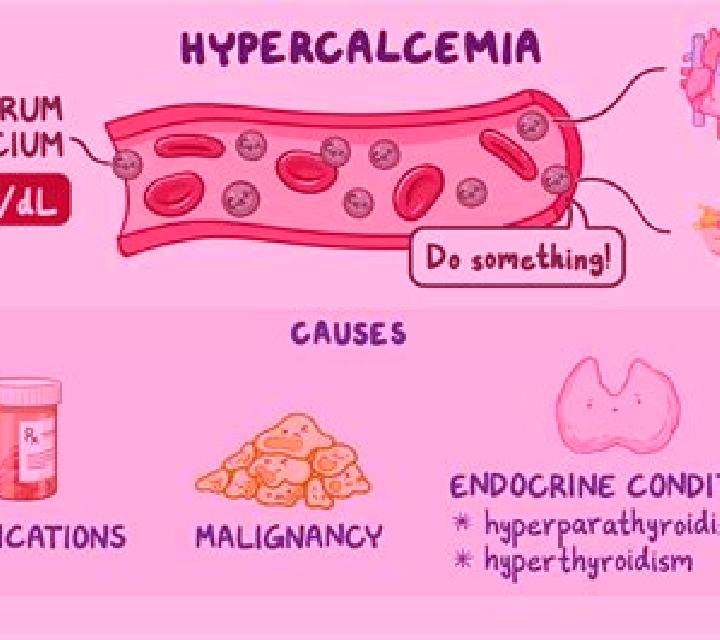 Lasix does lasix cause hypercalcemia pharmacy
