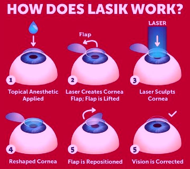 Lasix does lasix fix astigmatism medication