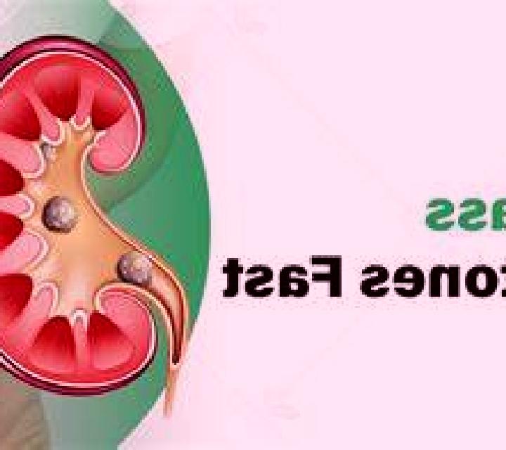 Lasix does lasix help pass kidney stones tablet