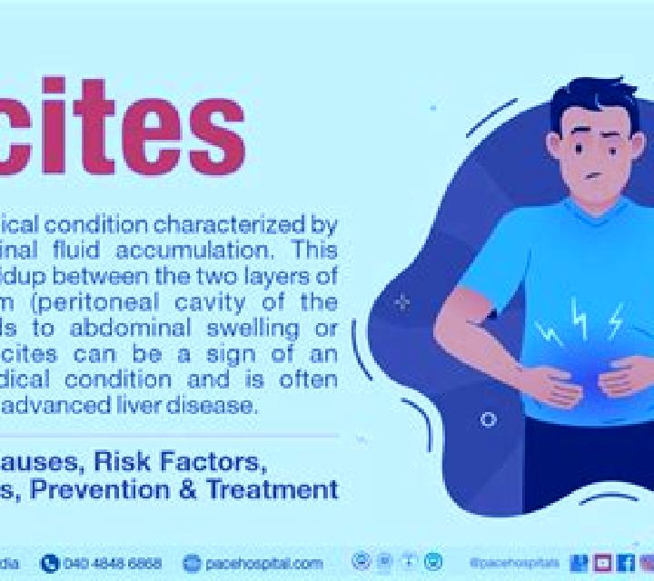 Lasix does lasix help with ascites medication