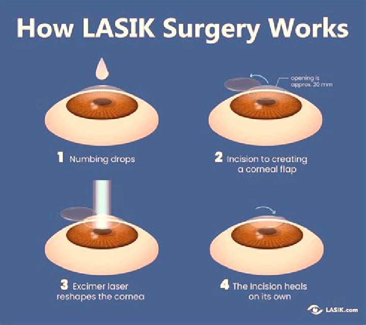 Lasix does lasix need to be redone tablet