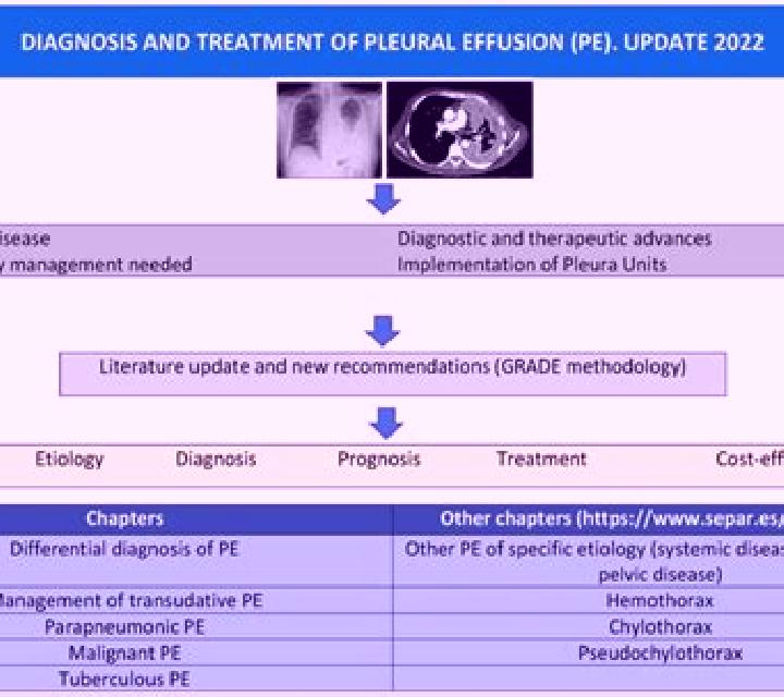 Lasix does lasix work for pleural effusion medication