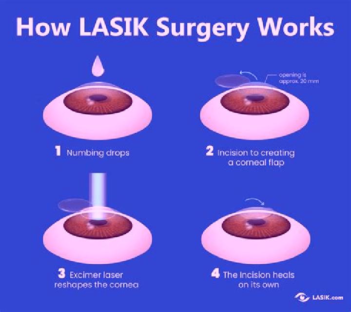 Lasix dr keil lasix surgery pharmacy