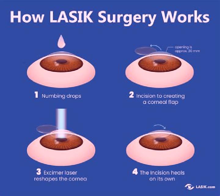 Lasix get lasix eye surgery or not tablet