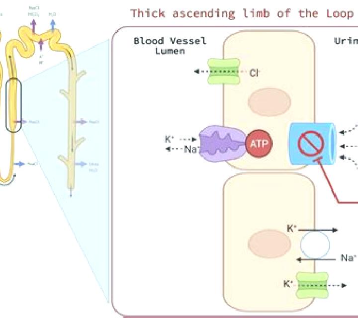 Lasix is lasix a loop medication