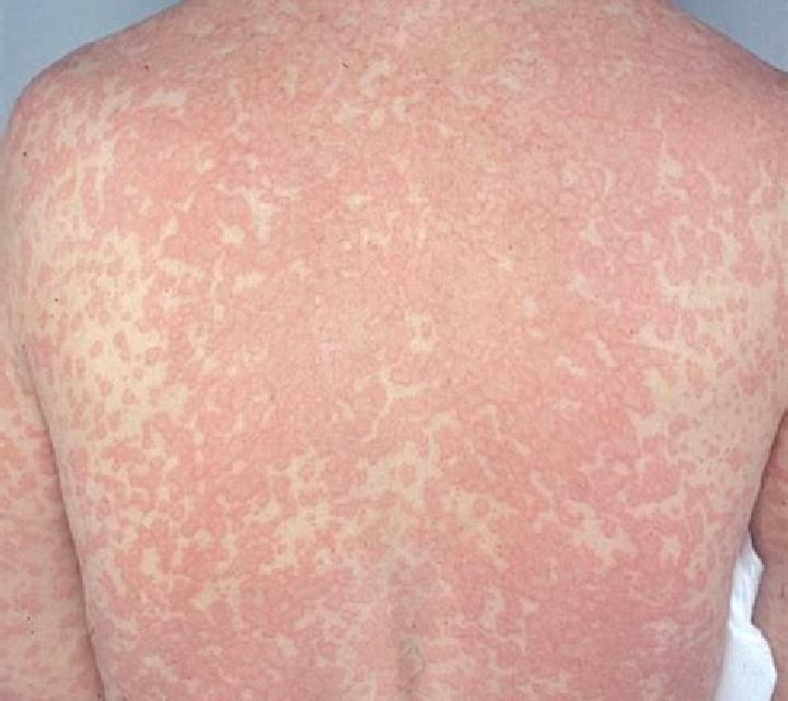 Lasix lasix 40 image medication