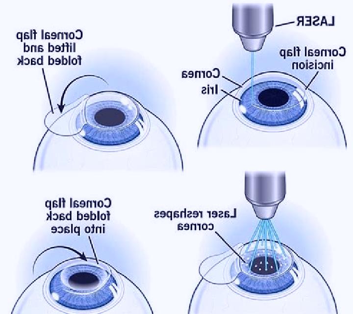 Lasix lasix after ablation medication