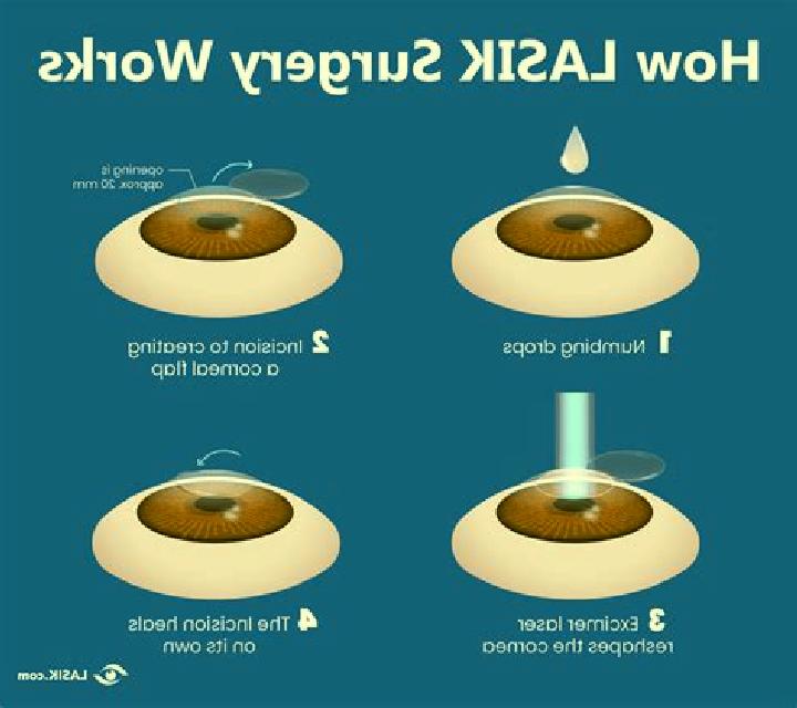 Lasix lasix eye surgery pills