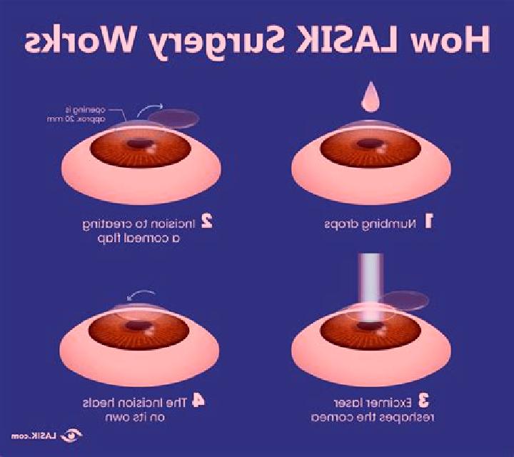 Lasix lasix laser pills