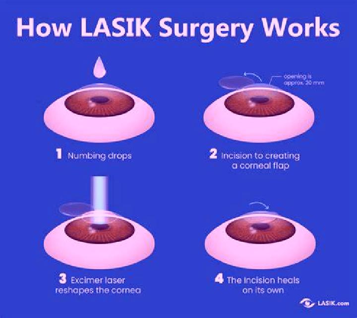 Lasix lasix procedure pharmacy