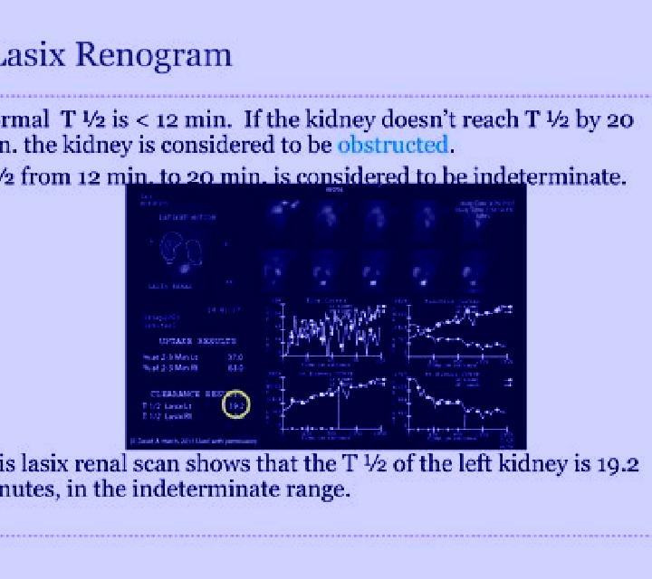 Lasix lasix renogram procedure pharmacy
