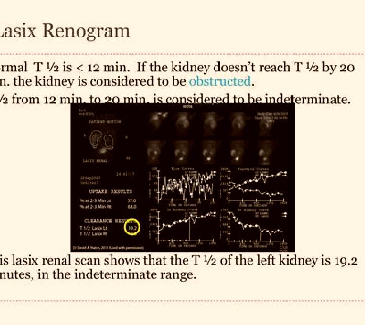 Lasix renogram without lasix pills