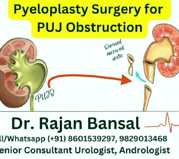 Lasix upj obstruction lasix medication