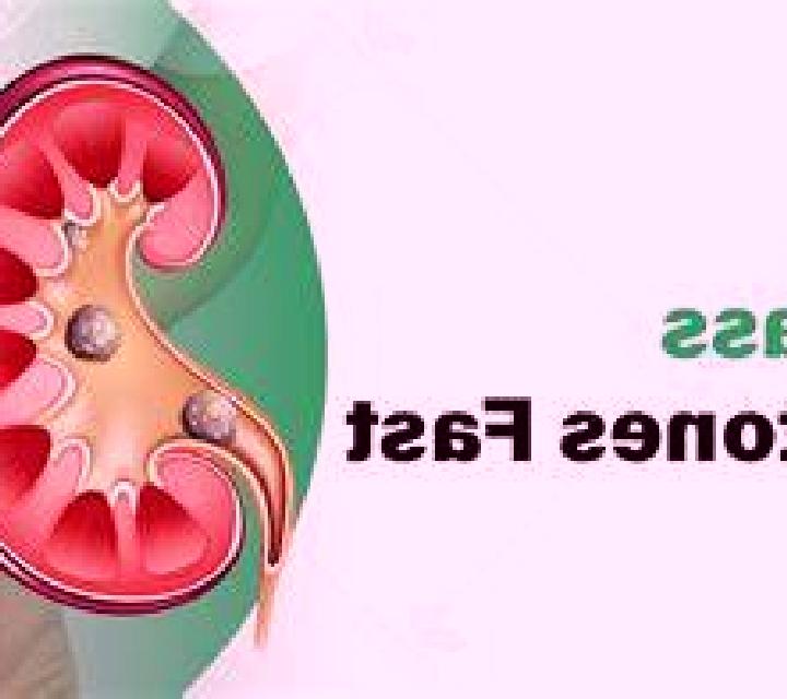 Lasix will lasix help pass a kidney stone tablet
