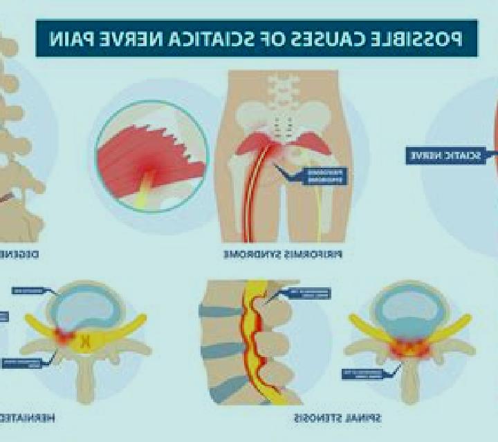 Neurontin can neurontin help sciatica medication