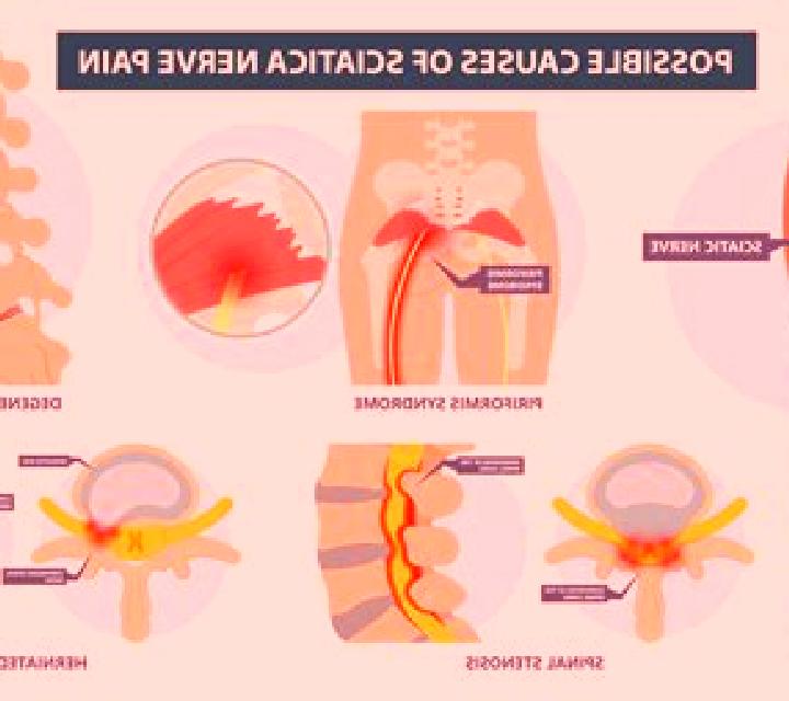 Neurontin can neurontin help with sciatica medication