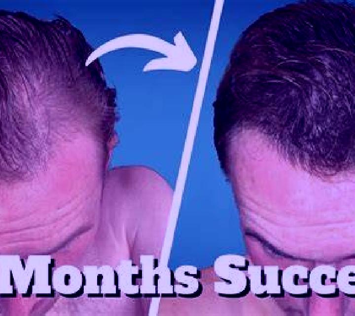 Propecia does propecia affect gains pills