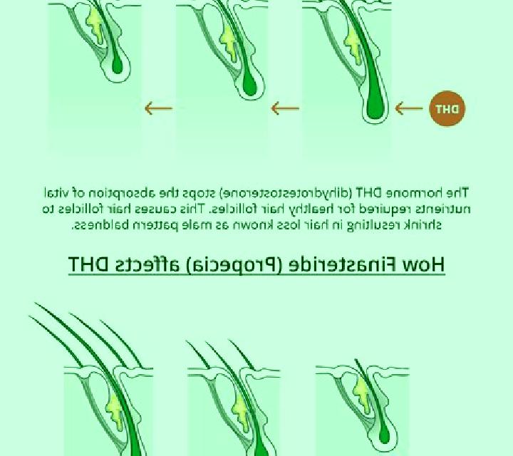 Propecia does propecia decrease dht pharmacy