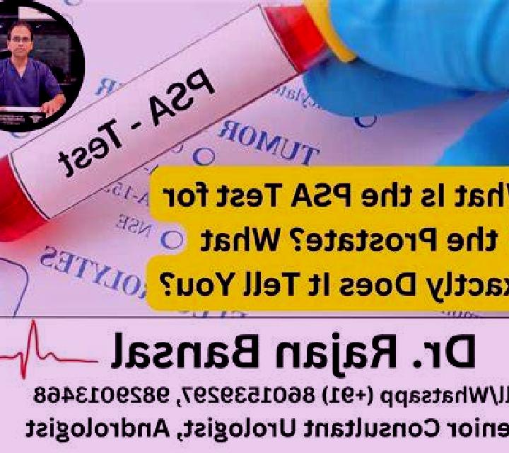 Propecia does propecia increase psa pills