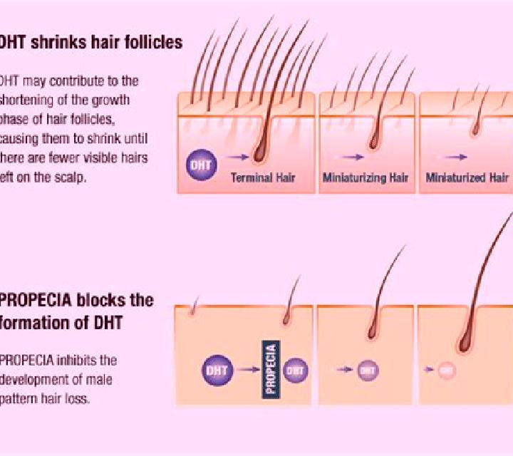 Propecia does propecia work on afro medication