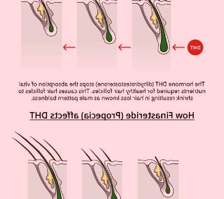 Propecia propecia dht reduction pharmacy